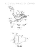 Tool For Insertion and Removal of In-Canal Hearing Devices diagram and image