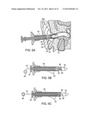 Tool For Insertion and Removal of In-Canal Hearing Devices diagram and image