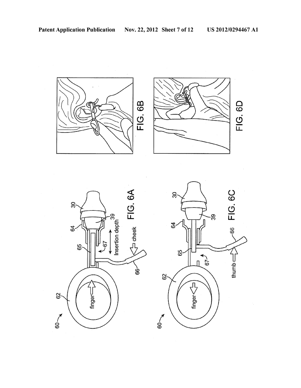 Tool For Insertion and Removal of In-Canal Hearing Devices - diagram, schematic, and image 08
