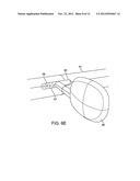 Tool For Insertion and Removal of In-Canal Hearing Devices diagram and image