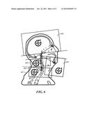 Method and Apparatus Pertaining to Images Used for Radiation-Treatment     Planning diagram and image