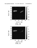 CONTRAST IMPROVEMENT METHOD AND SYSTEM FOR PHOTOACOUSTIC IMAGING diagram and image