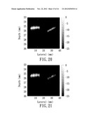 CONTRAST IMPROVEMENT METHOD AND SYSTEM FOR PHOTOACOUSTIC IMAGING diagram and image