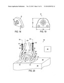 PERISTALTIC PUMP DEVICES, METHODS, AND SYSTEMS diagram and image