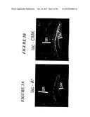 DNA regulatory element for the expression of transgenes in neurons of a     subject and uses thereof diagram and image