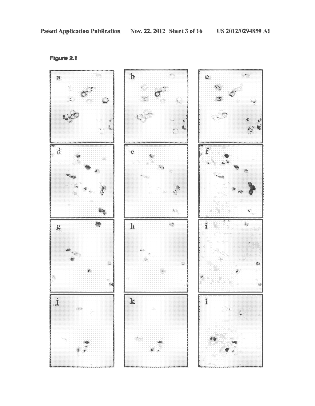 CANCER STEM CELL MARKERS AND USES THEREOF - diagram, schematic, and image 04