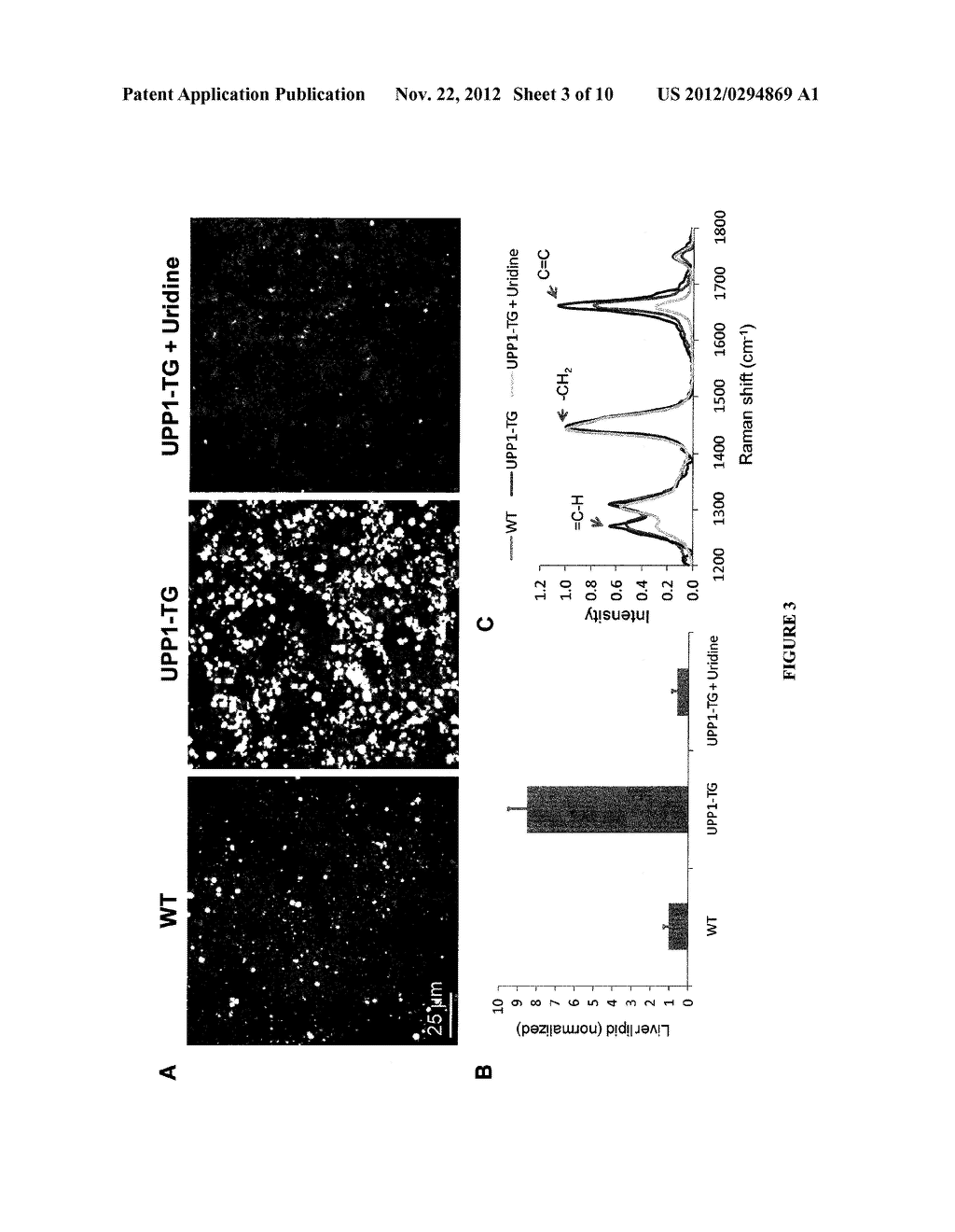 Methods for Treating Fatty Liver Disease - diagram, schematic, and image 04