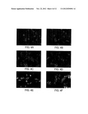 NOVEL COCHLEATE FORMULATIONS diagram and image