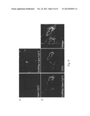 TARGET-AIMING DRUG DELIVERY SYSTEM FOR DIAGNOSIS AND TREATMENT OF CANCER     CONTAINING LIPOSOME LABELED WITH PEPTIDES WHICH SPECIFICALLY TARGETS     INTERLEUKIN-4 RECEPTORS, AND MANUFACTURING METHOD THEREOF diagram and image