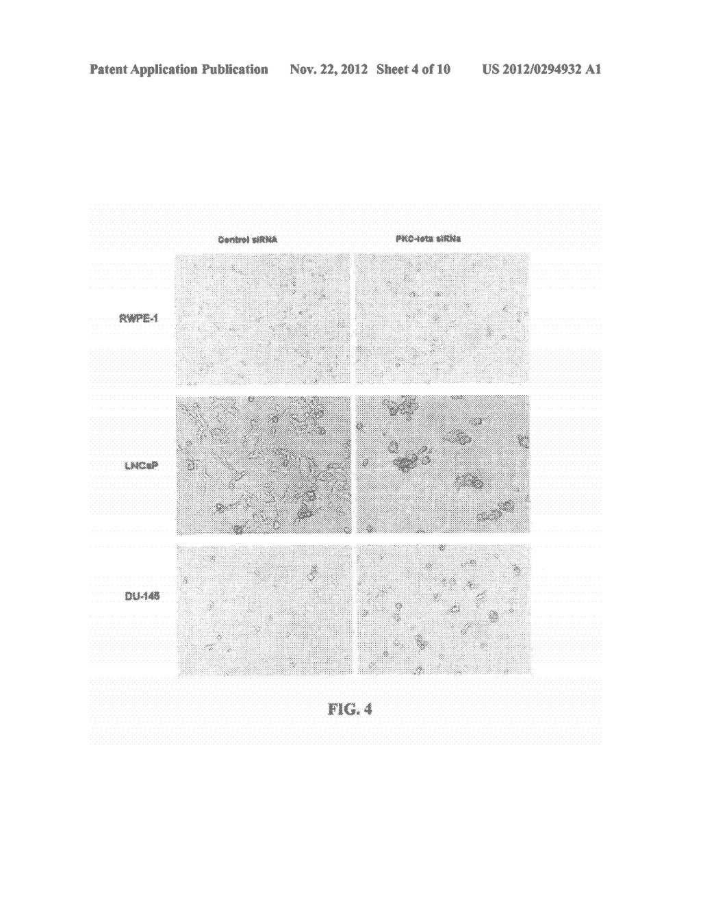 Prostate Carcinogenesis Predictor - diagram, schematic, and image 05