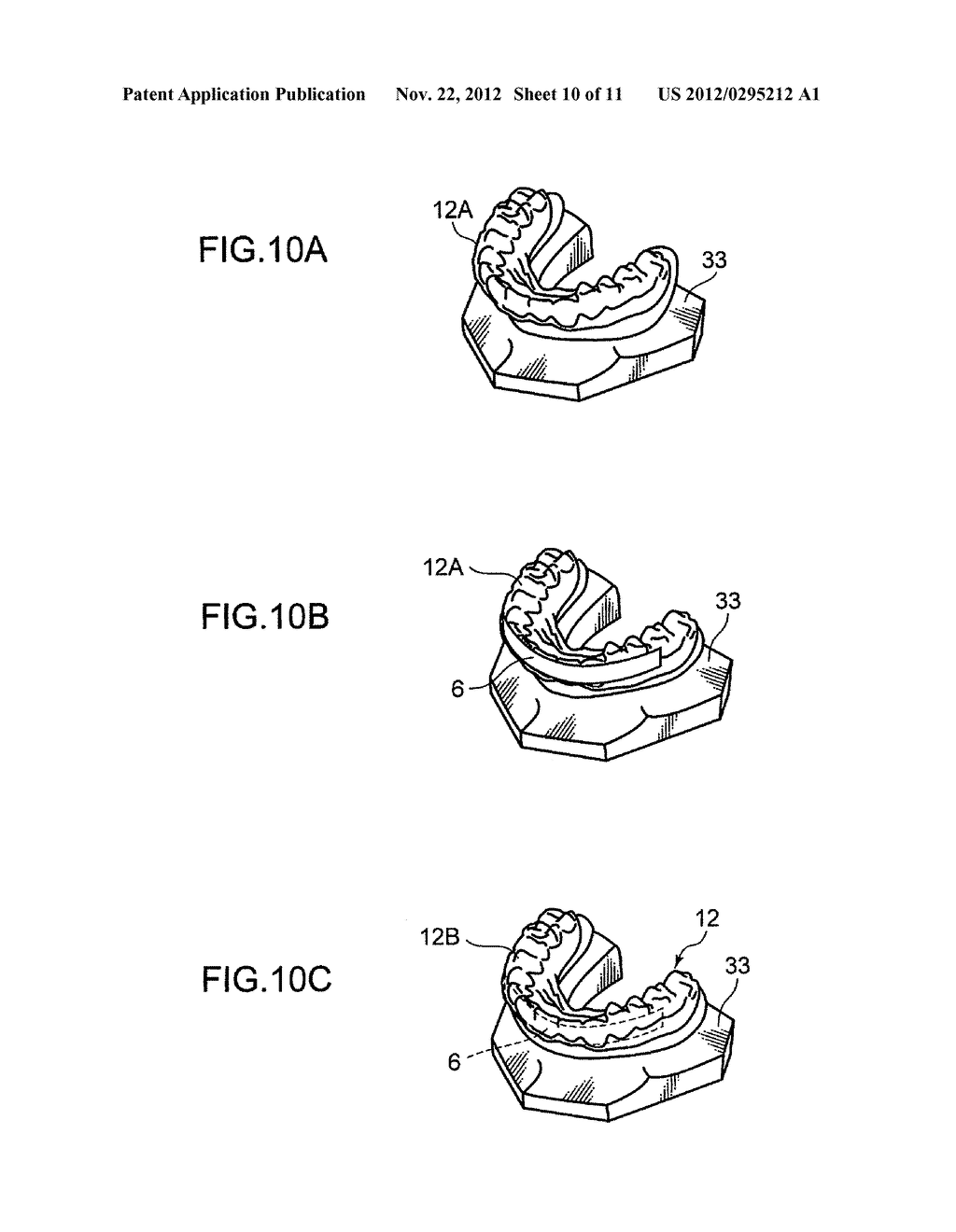 THERAPEUTIC DENTAL MOUTHPIECE-FORMING SUBSTRATE  AND PREFORMING METHOD     THEREOF - diagram, schematic, and image 11