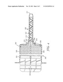 DENTAL AUTO-MIXING METHODS, DEVICES, AND COMPOSITIONS diagram and image