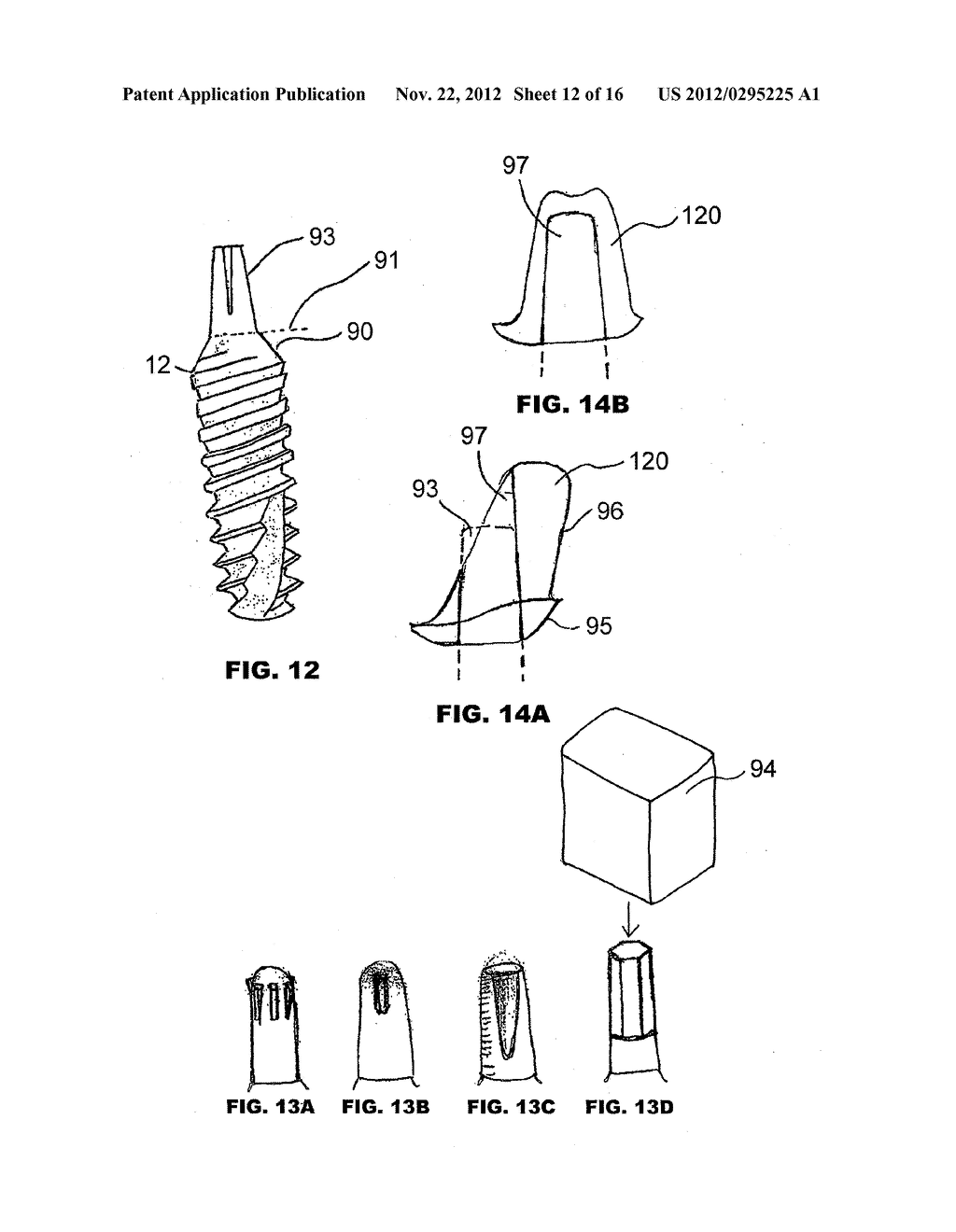 CONDENSING SKELETAL IMPLANT THAT FACILITATE INSERTIONS - diagram, schematic, and image 13