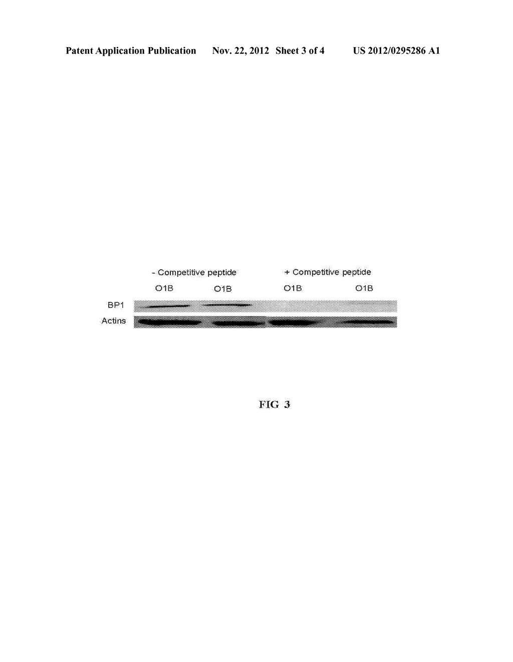 Methods for the Diagnosis, Prognosis and Monitoring of Cancer Therapy     Using BP1 - diagram, schematic, and image 04