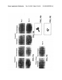 Prospective Identification and Characterization of Breast Cancer Stem     Cells diagram and image