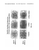 Prospective Identification and Characterization of Breast Cancer Stem     Cells diagram and image