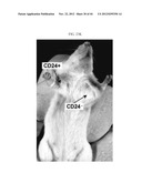 Prospective Identification and Characterization of Breast Cancer Stem     Cells diagram and image