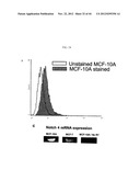 Prospective Identification and Characterization of Breast Cancer Stem     Cells diagram and image