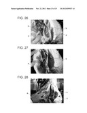 DEBONING METHOD AND APPARATUS FOR MEAT WITH BONE USING X-RAY diagram and image