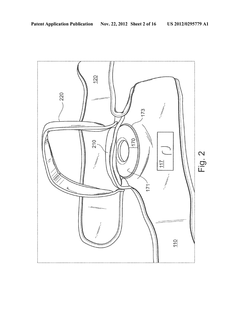 Piri-Stretcher - diagram, schematic, and image 03