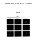 METHODS AND COMPOSITIONS FOR CANCER TREATMENT RELATING TO BRCA1 BRCT     DOMAIN RECOGNITION OF PHOSPHORYLATED BACH1 diagram and image