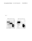 METHOD FOR EXTRACTING STAPHYLOCOCCUS AUREUS ANTIGEN, REAGENT FOR     EXTRACTING STAPHYLOCOCCUS AUREUS ANTIGEN, AND METHOD FOR ASSESSING     STAPHYLOCCOCCUS AUREUS diagram and image