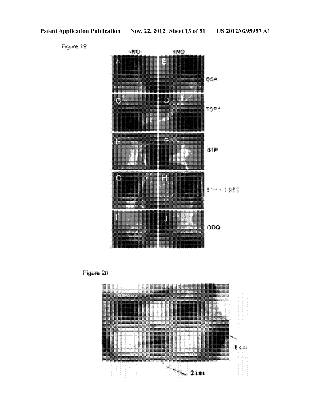 PREVENTION OF TISSUE ISCHEMIA AND RELATED COMPOSITIONS - diagram, schematic, and image 14