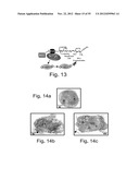 AGENTS, COMPOSITIONS AND METHODS FOR TREATING PATHOLOGIES IN WHICH     REGULATING AN ACHE-ASSOCIATED BIOLOGICAL PATHWAY IS BENEFICIAL diagram and image