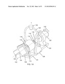 METHODS OF CONTROLLING MAGNETIC NANOPARTICLES TO IMPROVE VASCULAR FLOW diagram and image