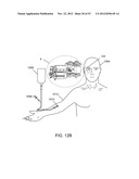 METHODS OF CONTROLLING MAGNETIC NANOPARTICLES TO IMPROVE VASCULAR FLOW diagram and image