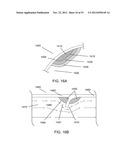 METHODS OF CONTROLLING MAGNETIC NANOPARTICLES TO IMPROVE VASCULAR FLOW diagram and image