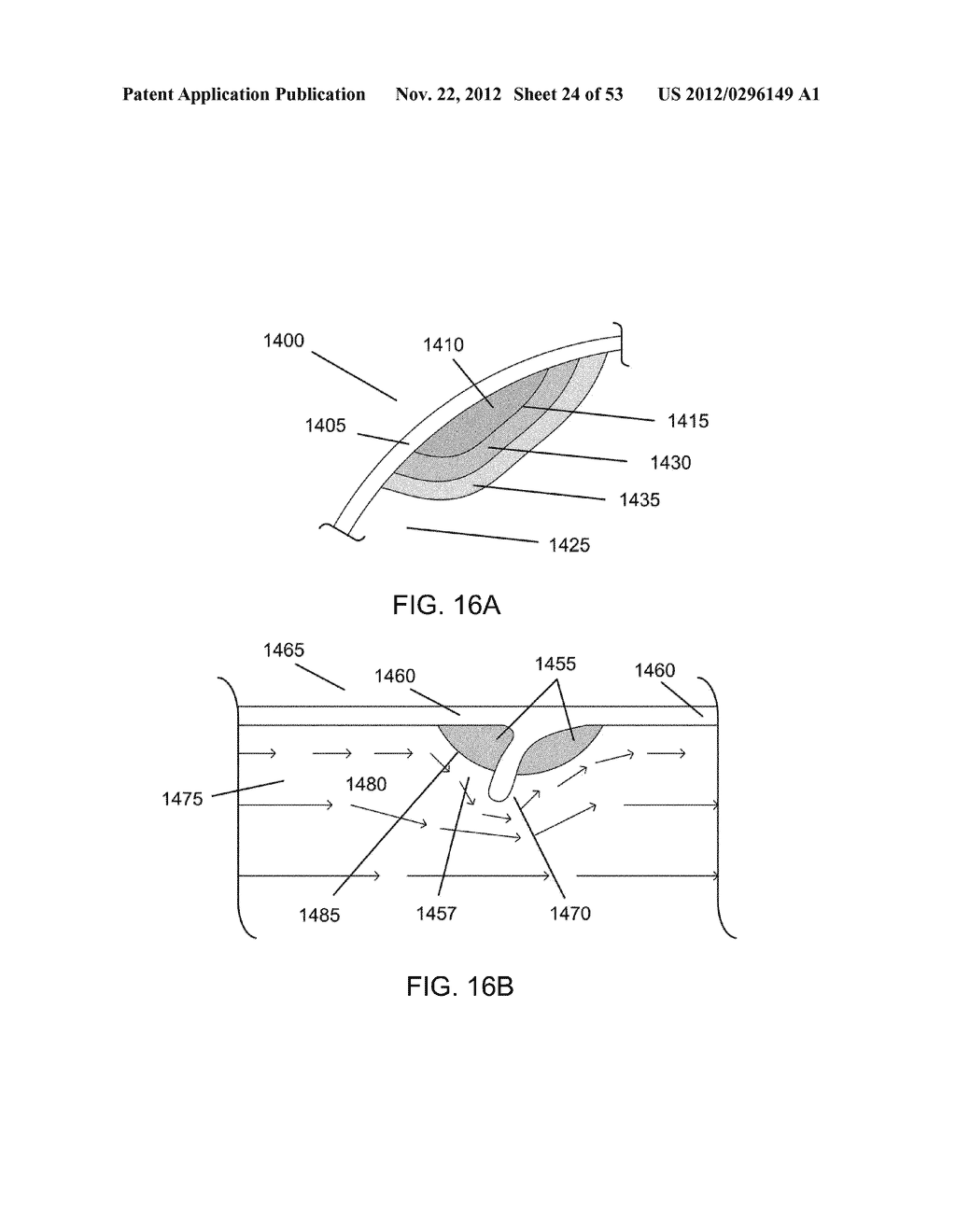 METHODS OF CONTROLLING MAGNETIC NANOPARTICLES TO IMPROVE VASCULAR FLOW - diagram, schematic, and image 25