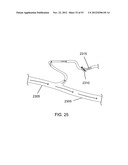 METHODS OF CONTROLLING MAGNETIC NANOPARTICLES TO IMPROVE VASCULAR FLOW diagram and image