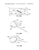 METHODS OF CONTROLLING MAGNETIC NANOPARTICLES TO IMPROVE VASCULAR FLOW diagram and image