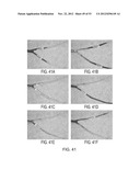 METHODS OF CONTROLLING MAGNETIC NANOPARTICLES TO IMPROVE VASCULAR FLOW diagram and image