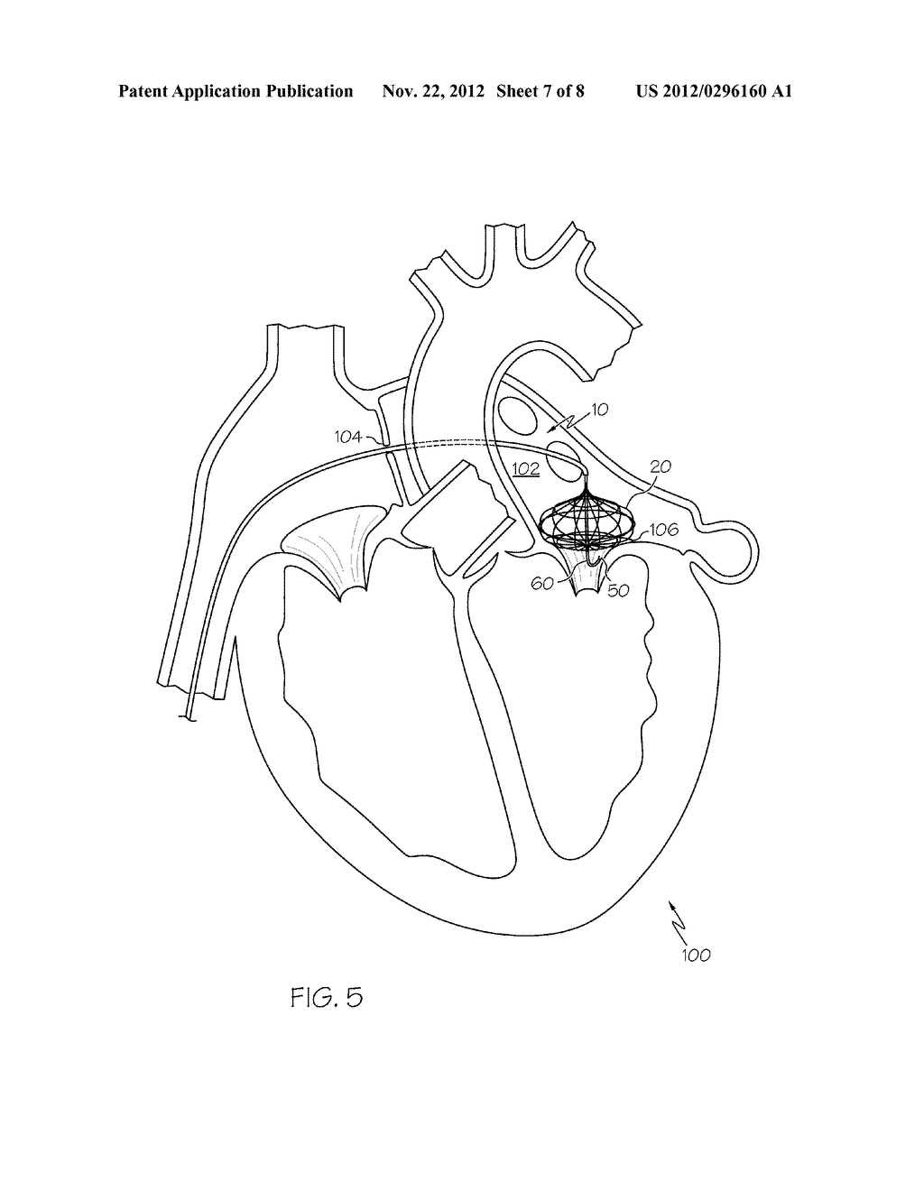 Positioning Cage - diagram, schematic, and image 08