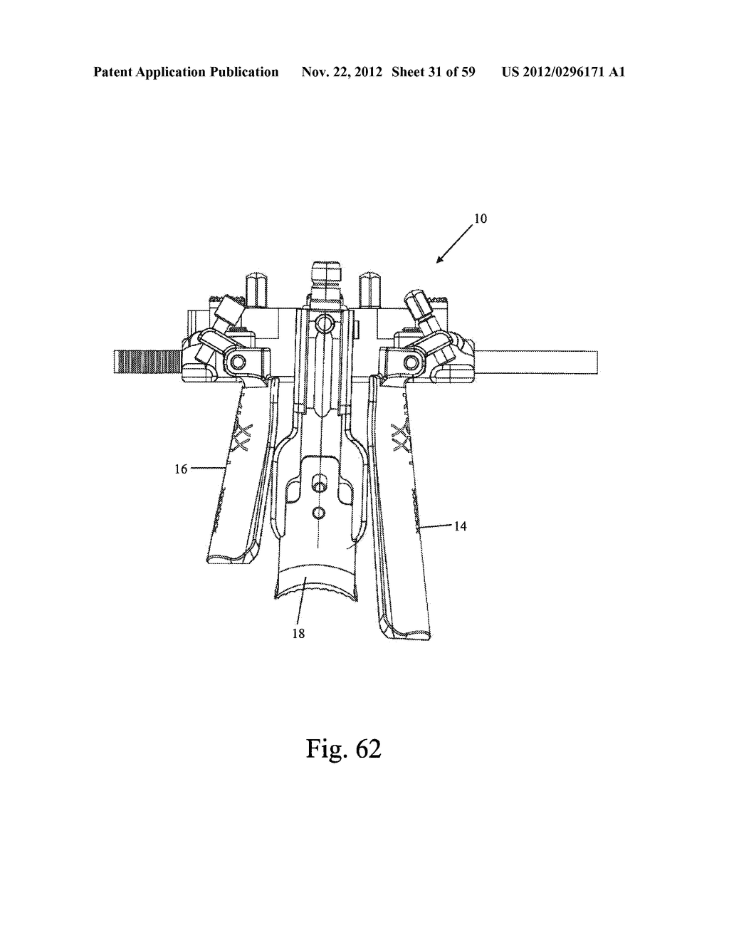 Method and Apparatus for Performing Spinal Fusion Surgery - diagram, schematic, and image 32