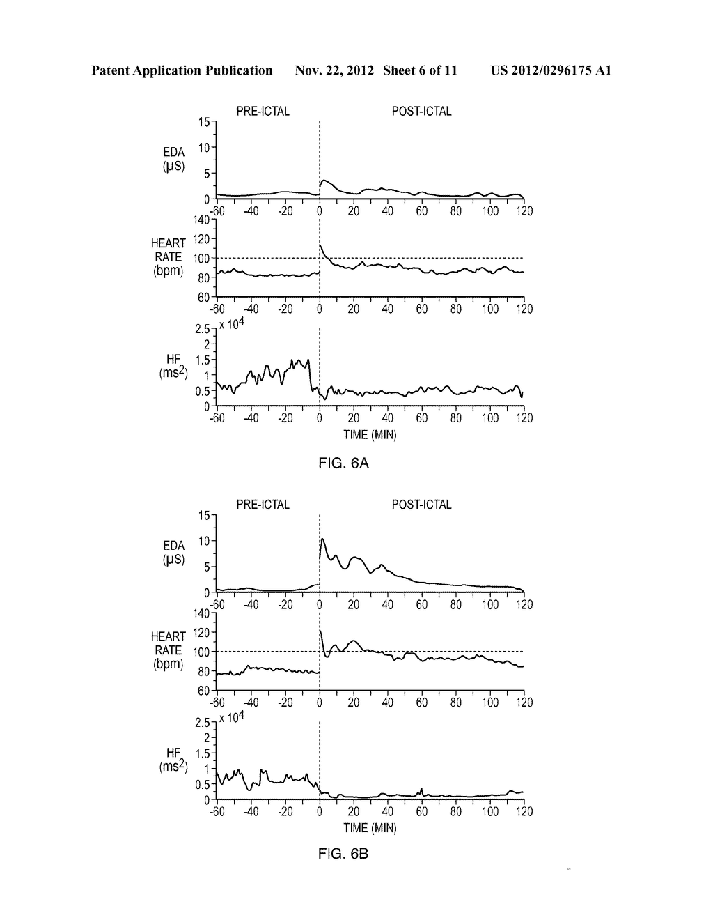 Methods and apparatus for assessment of atypical brain activity - diagram, schematic, and image 07