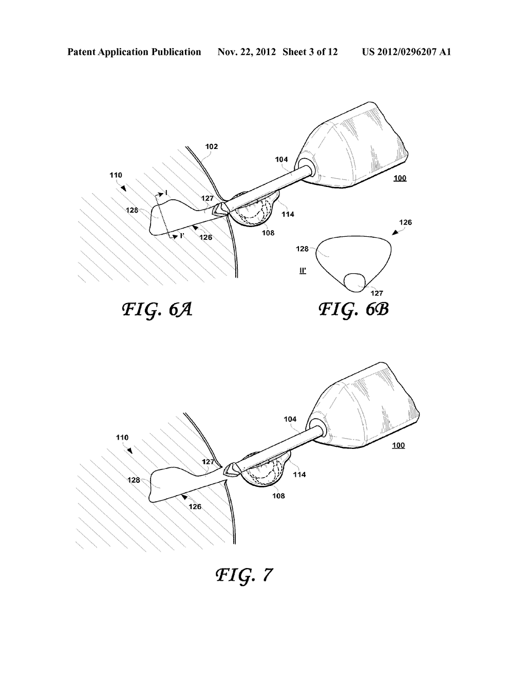 POST-BIOPSY CAVITY TREATMENT IMPLANTS AND METHODS - diagram, schematic, and image 04