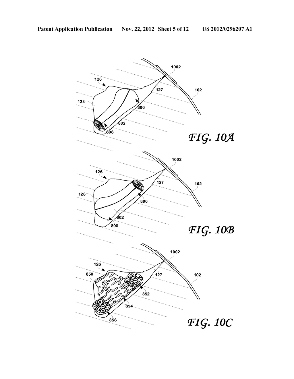 POST-BIOPSY CAVITY TREATMENT IMPLANTS AND METHODS - diagram, schematic, and image 06