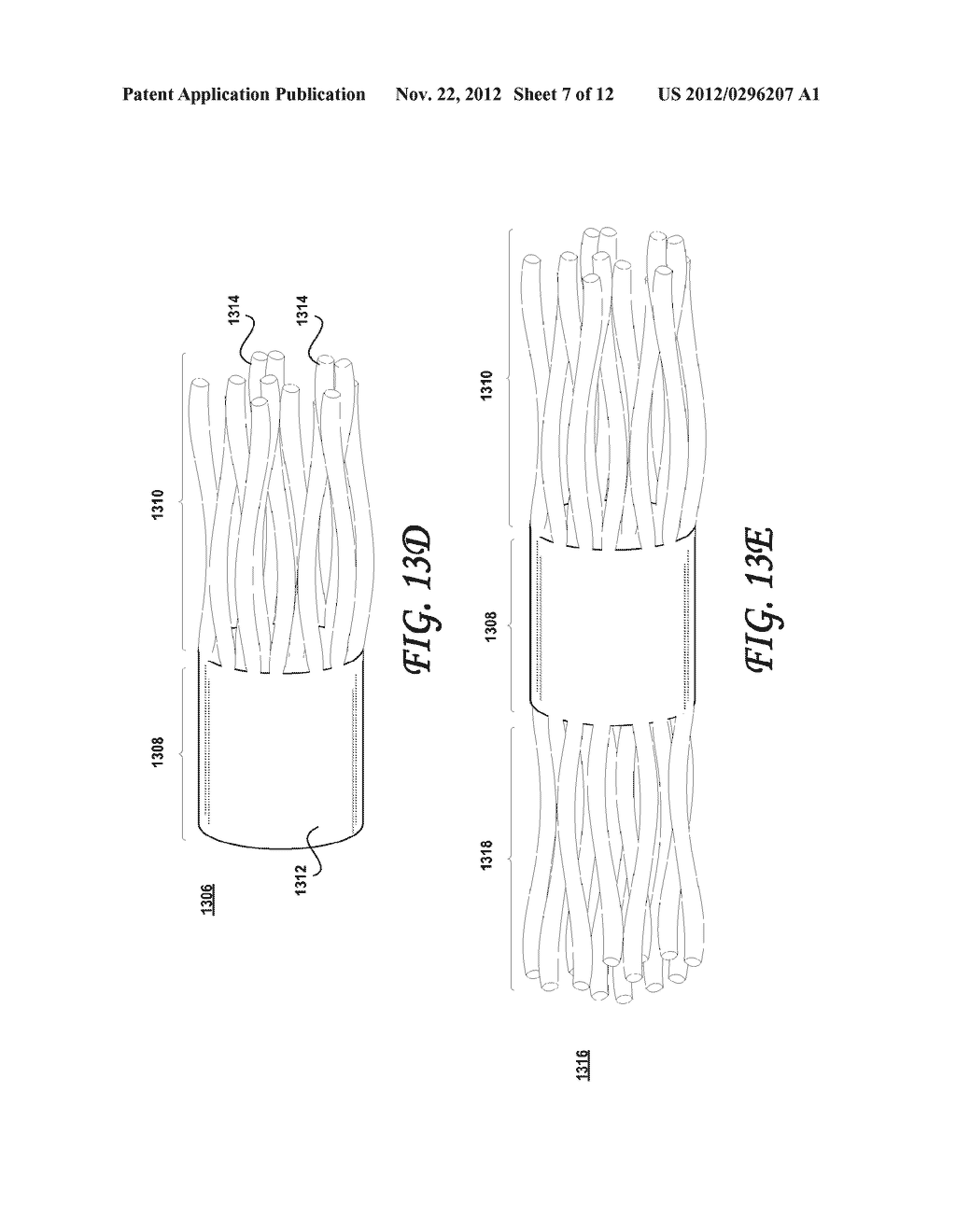 POST-BIOPSY CAVITY TREATMENT IMPLANTS AND METHODS - diagram, schematic, and image 08