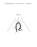 ULTRASONIC IMAGING DEVICE AND INFORMATION PROCESSING DEVICE diagram and image