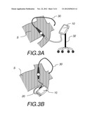 WIRELESS NETWORK HAVING PORTABLE ULTRASOUND DEVICES diagram and image