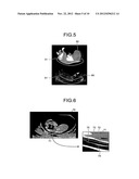 ULTRASOUND DIAGNOSTIC APPARATUS, CONTROL METHOD, AND IMAGE PROCESSING     APPARATUS diagram and image