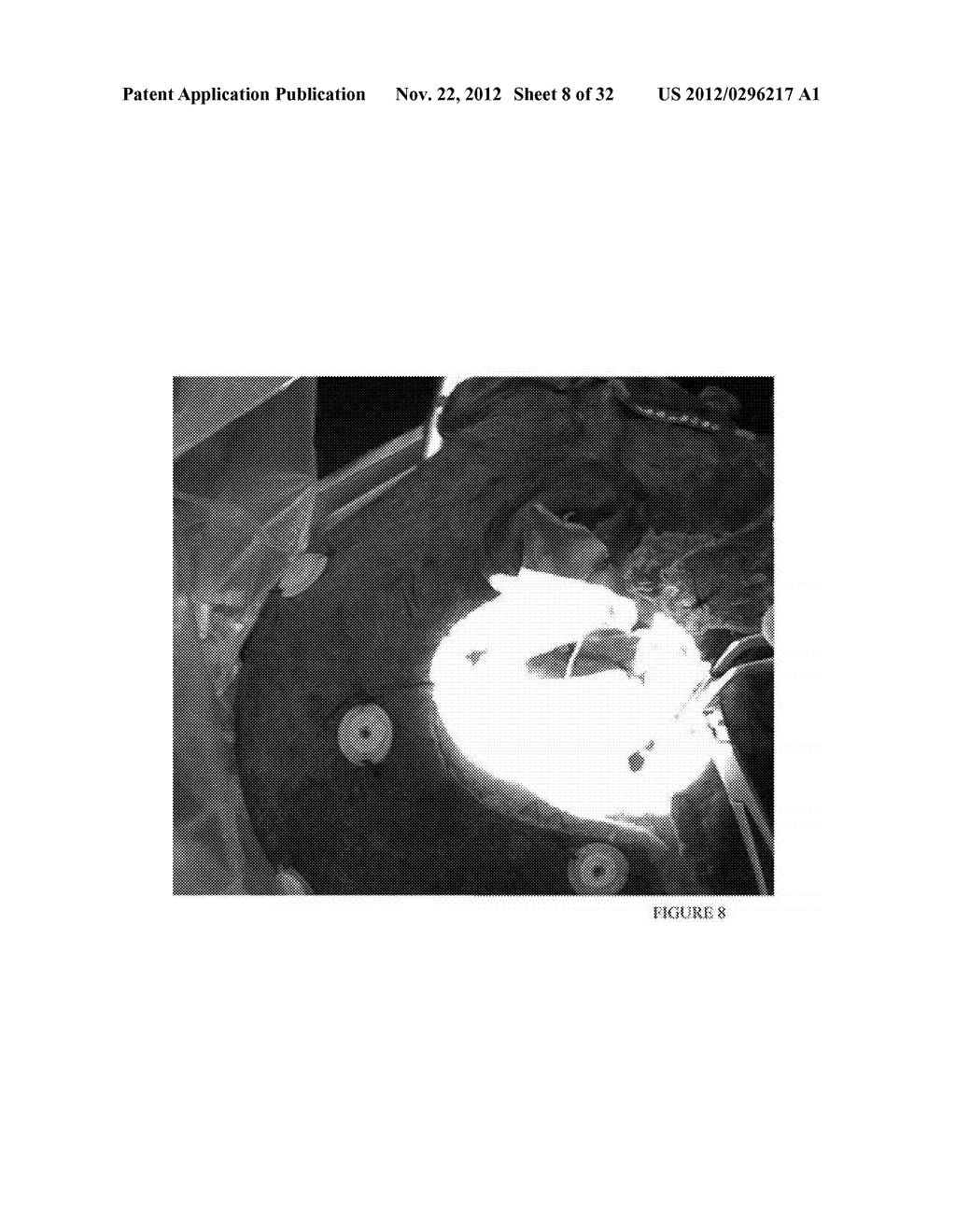 METHOD AND APPARATUS FOR DELIVERING AN ENDOSCOPE VIA MICROSURGICAL     INSTRUMENTS WHILE PERFORMING MICROSCOPIC SURGERY - diagram, schematic, and image 09