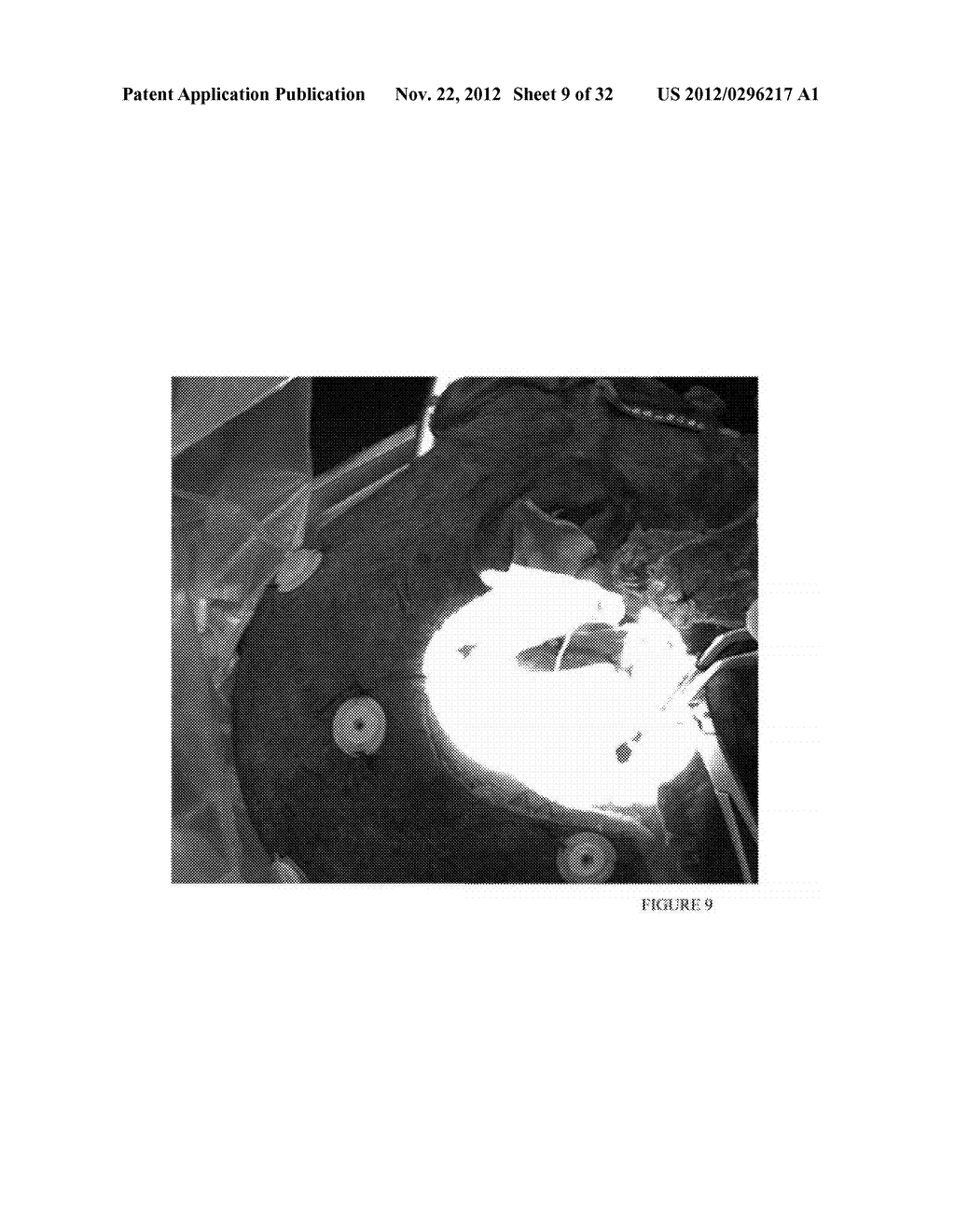 METHOD AND APPARATUS FOR DELIVERING AN ENDOSCOPE VIA MICROSURGICAL     INSTRUMENTS WHILE PERFORMING MICROSCOPIC SURGERY - diagram, schematic, and image 10