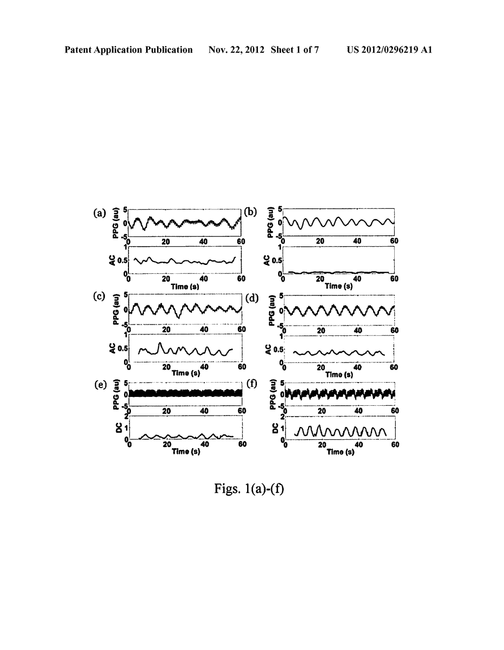 APPARATUS AND METHOD FOR RESPIRATORY RATE DETECTION AND EARLY DETECTION OF     BLOOD LOSS VOLUME - diagram, schematic, and image 02