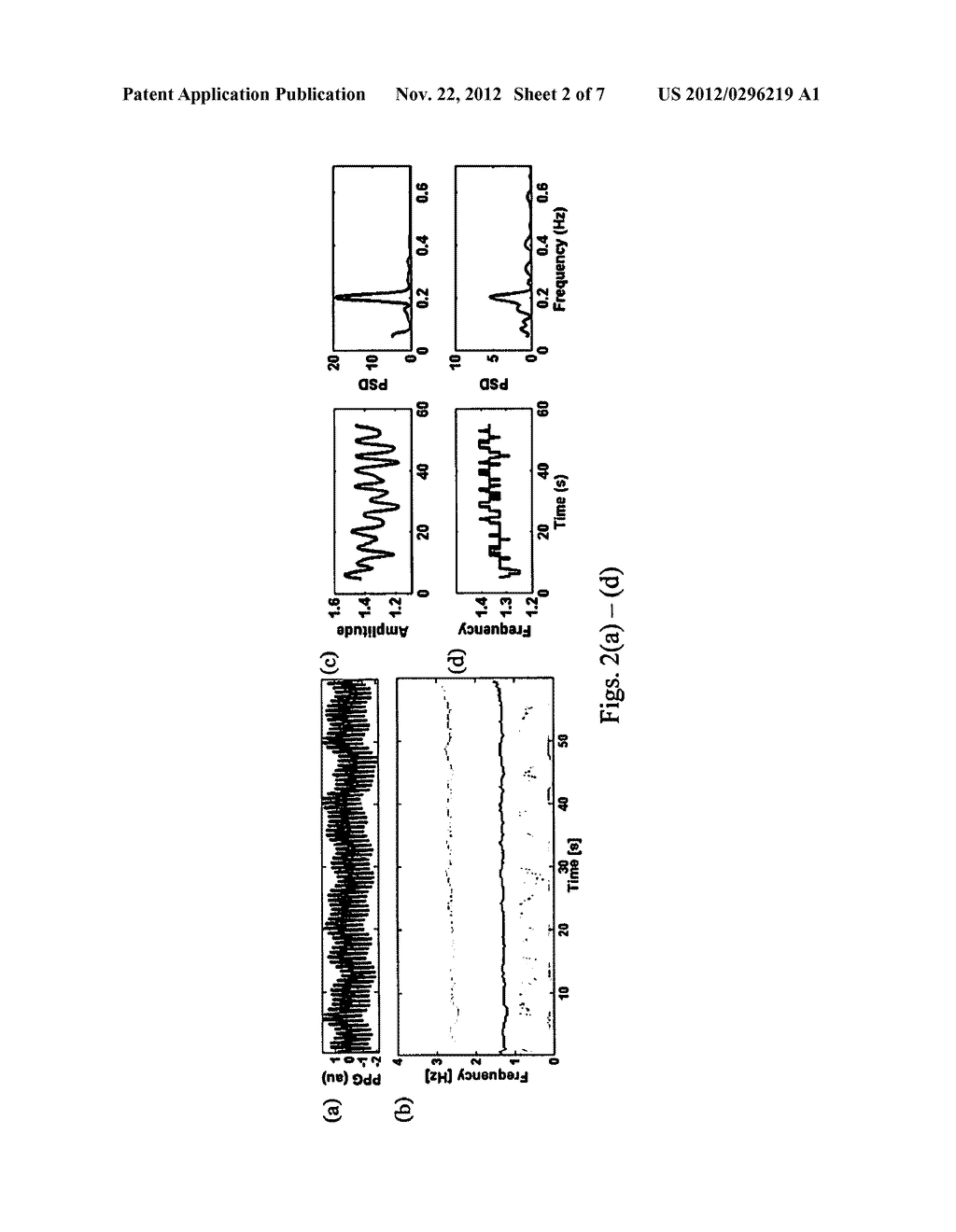 APPARATUS AND METHOD FOR RESPIRATORY RATE DETECTION AND EARLY DETECTION OF     BLOOD LOSS VOLUME - diagram, schematic, and image 03