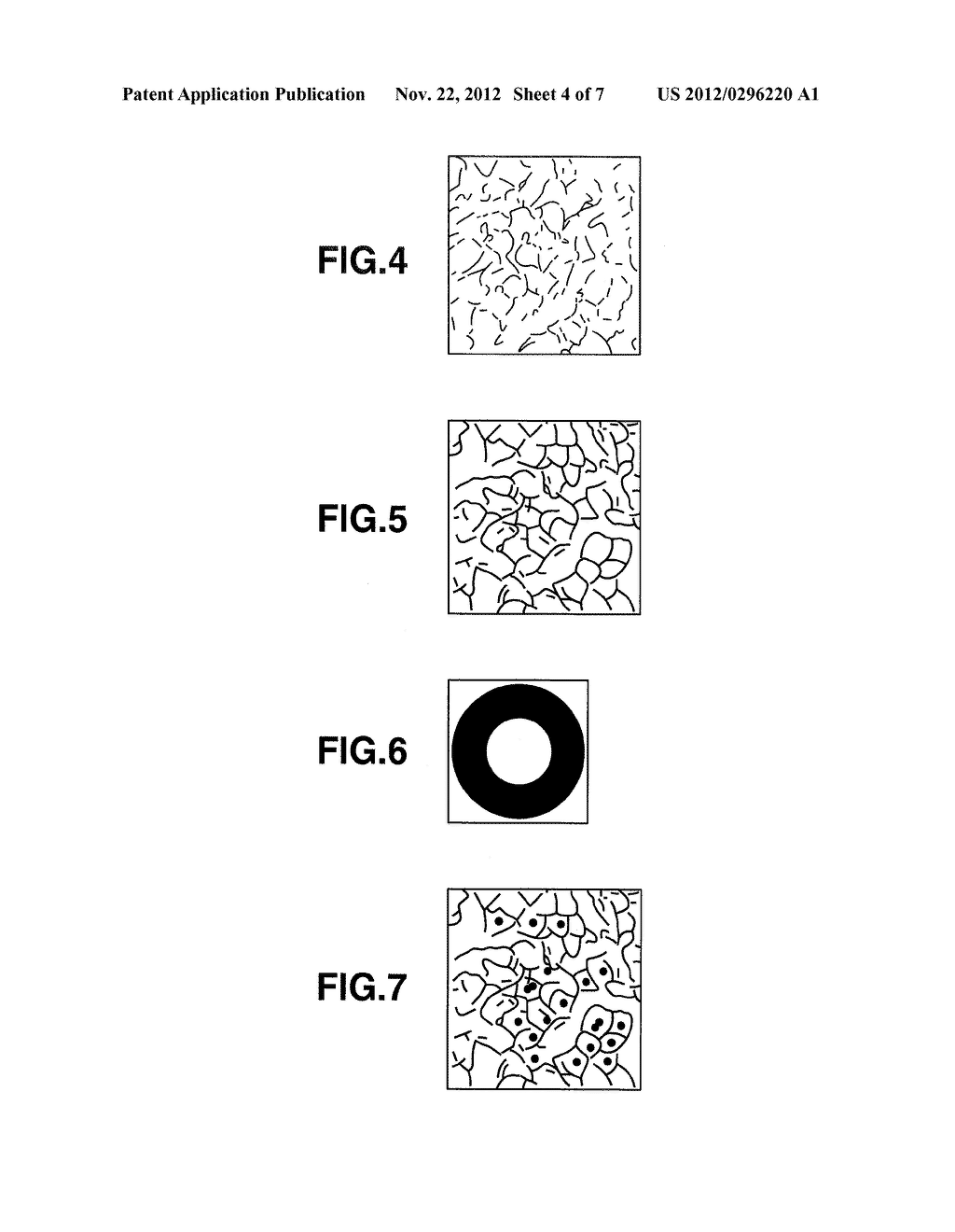 DIAGNOSIS SUPPORTING APPARATUS AND CONTROL METHOD OF DIAGNOSIS SUPPORTING     APPARATUS - diagram, schematic, and image 05