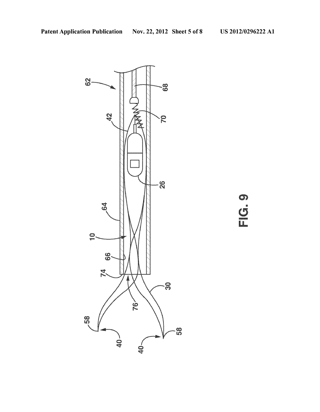 Implantable Medical Sensor and Anchoring System - diagram, schematic, and image 06